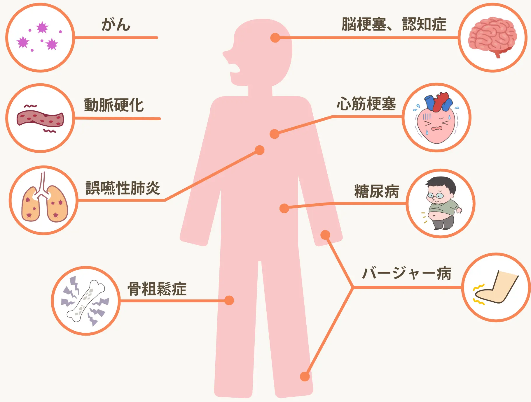 体の病気と歯周病　がん、動脈硬化、誤嚥性肺炎、骨粗鬆症、脳梗塞、心筋梗塞、糖尿病、パージャー病