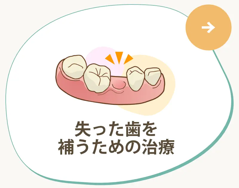 失った歯を補うための治療