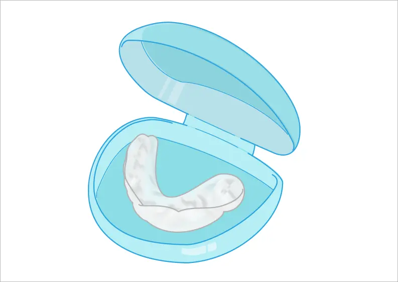 マウスピースの作成