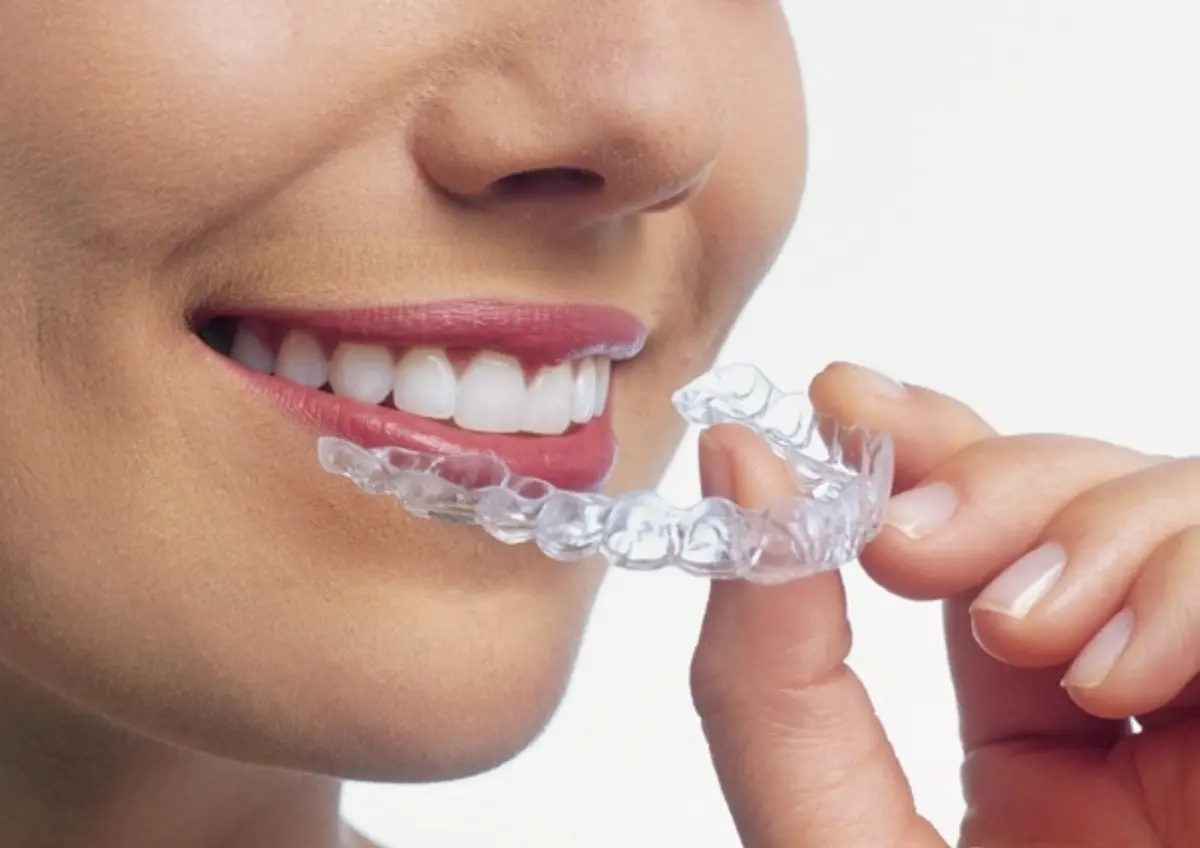 目立たずに矯正治療「インビザライン」