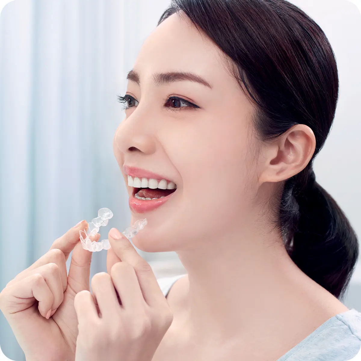 前歯のみの矯正