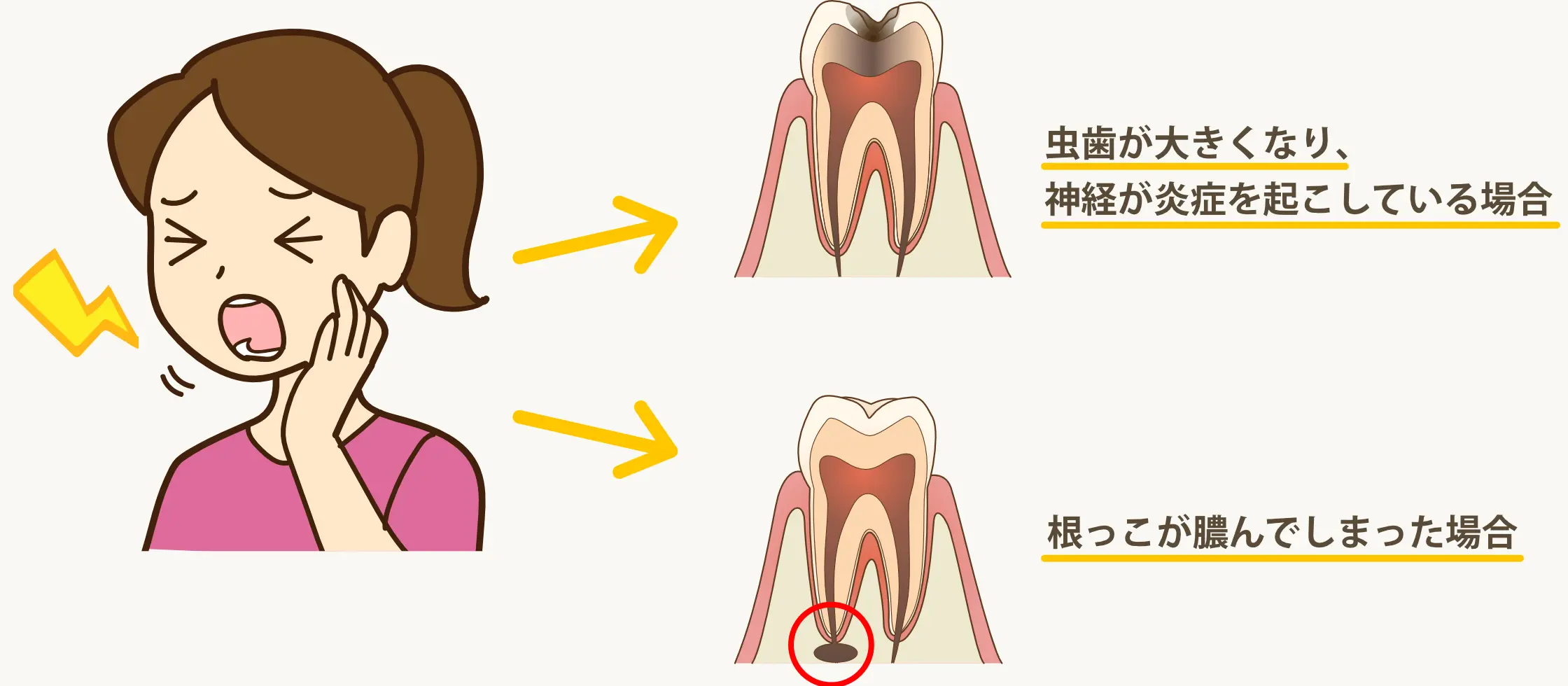 「神経の治療」はこんな時におこないます