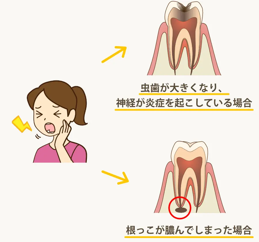 「神経の治療」はこんな時に行います