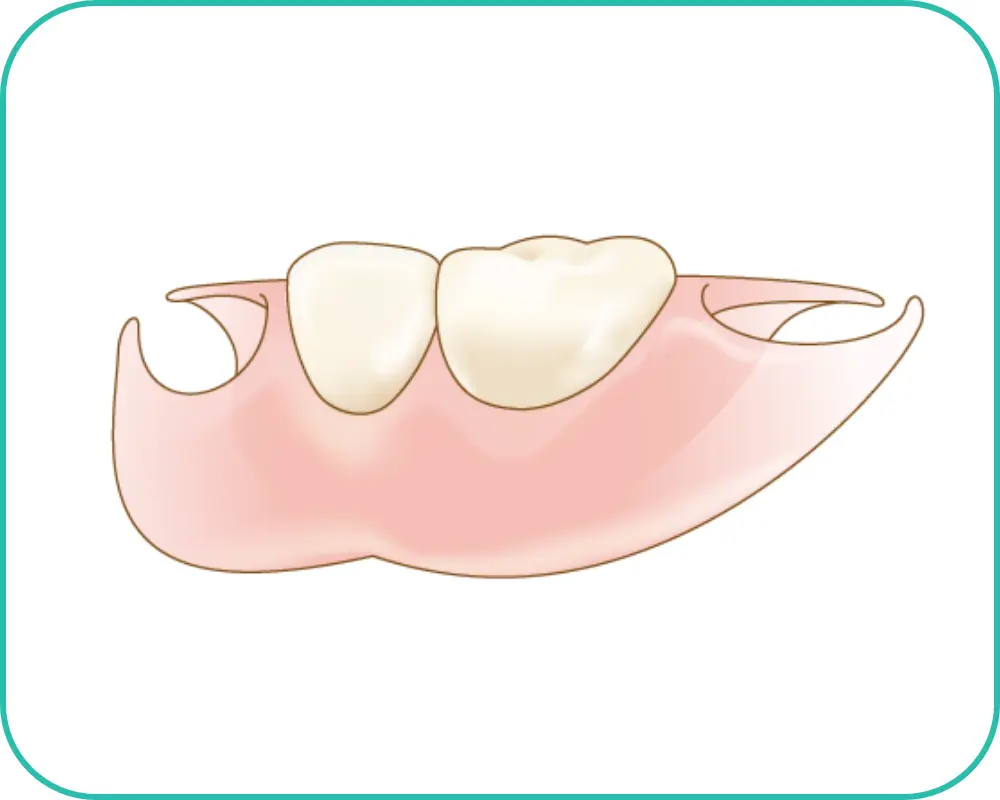 入れ歯ノンクラスプ
