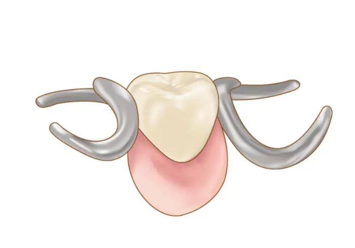 入れ歯（保険）