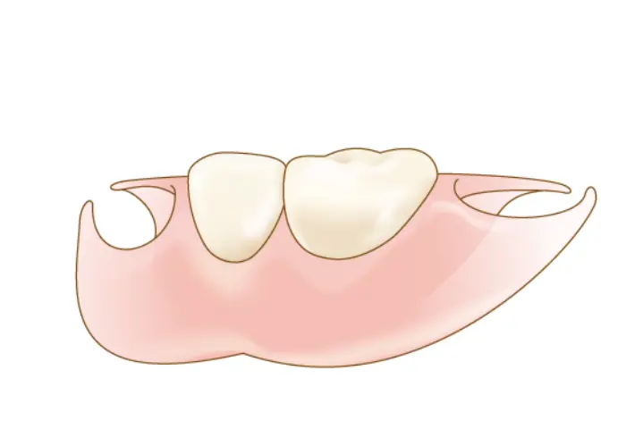 入れ歯（ノンクラスプ）